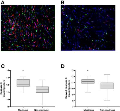 Apoptotic and Necroptotic Mediators are Differentially Expressed in Mucinous and Non-Mucinous Colorectal Cancer